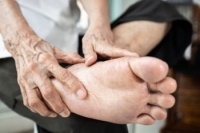 Rheumatoid Arthritis and Foot Health