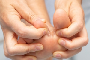 Symptoms and Diagnosis of Athlete’s Foot