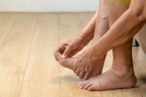 Osteoarthritis of the Big Toe