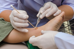 Wound Care in Podiatry